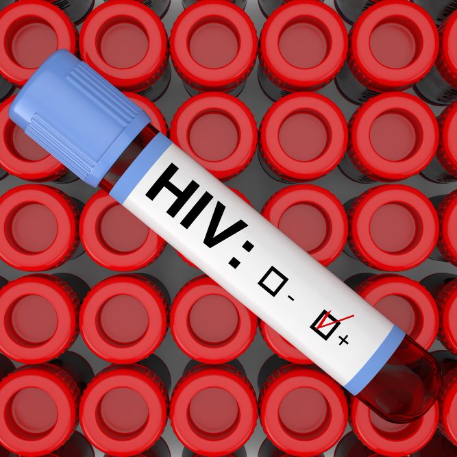 Статистика ВИЧ среди подростков и молодежи в США